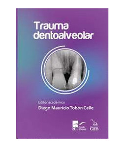 Trauma Dentoalveolar