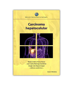 Carcinoma Hepatocelular